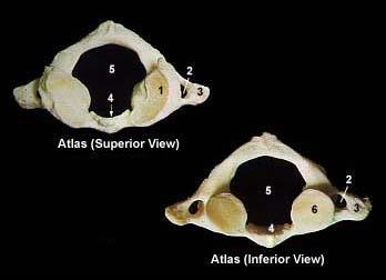 Atlas 1. Superior Articular Surface 2. Transverse Foramen 3.