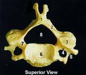 Cervical (C3 - C7) 1. Spinous Process 2. Lamina 3. Superior Articular Surface 4.