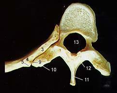 Angle of Rib Rib & Vertebra Articulated 7. Costal Groove 8. Body of Rib 9.