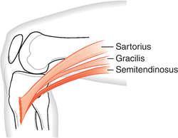 10 M. Sartorius Spina iliaka anterior superiordan başlayarak uyluğun anteriorundan femoral apenörozun altından ve medialden distale doğru ilerler. Pes anserinusa katılarak tibiaya yapışır (Resim 2.