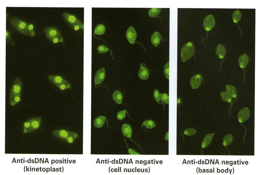 Anti DNA