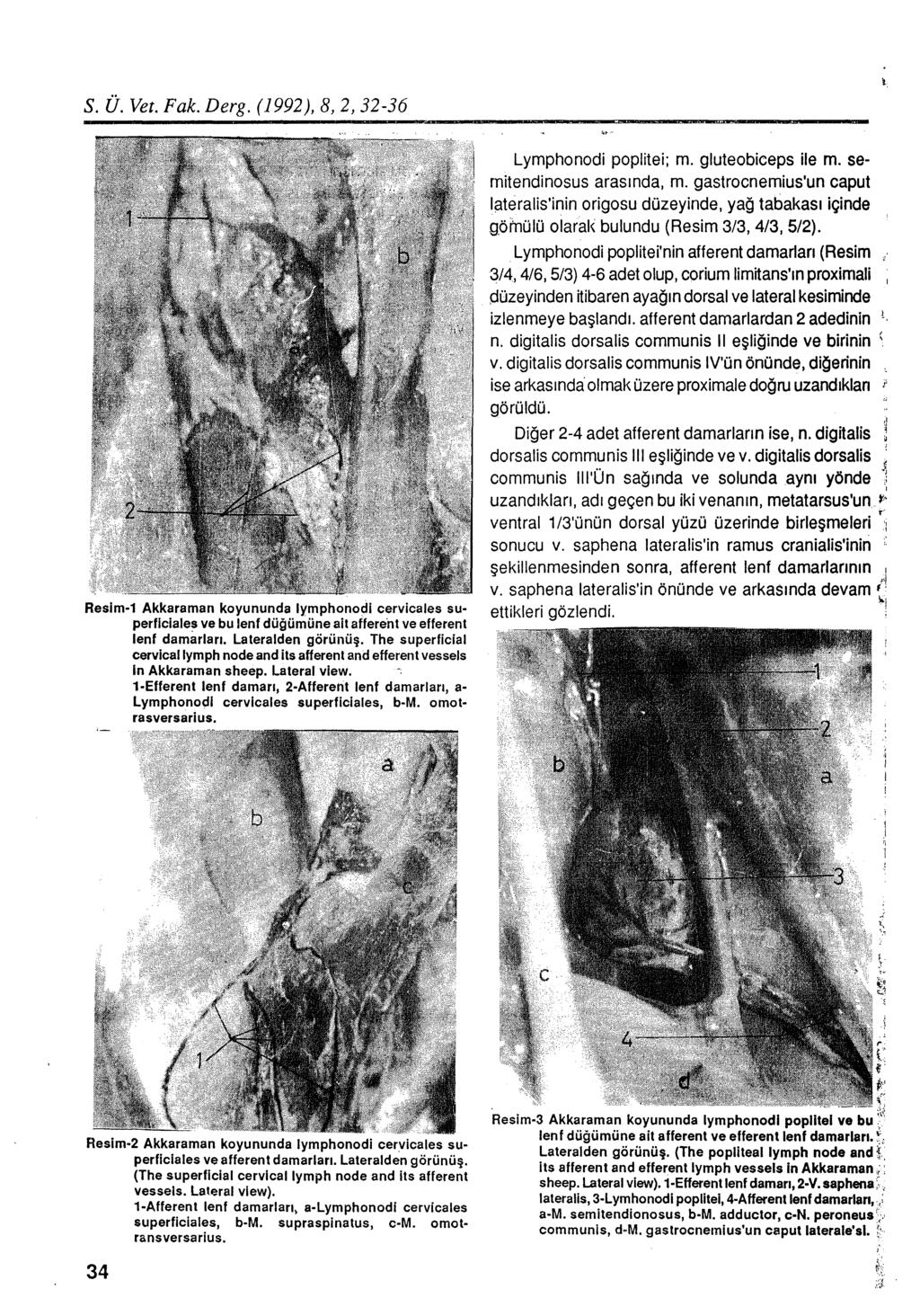 S. Ü. Vet. Fak. Derg. (1992), 8, 2, 32-36 Resim-1 Akkaraman koyununda lymphonodi cervicales superflciales ve bu lenf düğümüne ait affere'nt ve efferent lenf damarları. Lateralden görünüş.