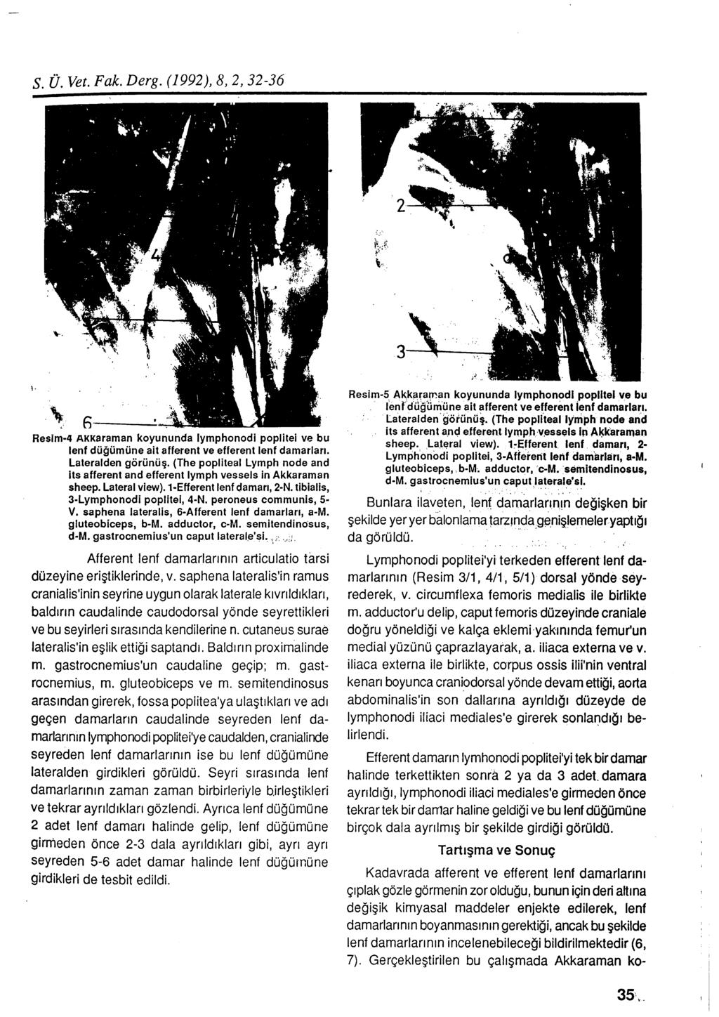 S. ü. Vet. Fak. Derg. (1992), 8, 2, 32-36 \.. '\--. l. \ Resim-4 AKKaraman koyununda lymphonodi poplitei ve bu lenf düğümüne ait afferent ve efferent lenf damarları. Lateralden görünüş.