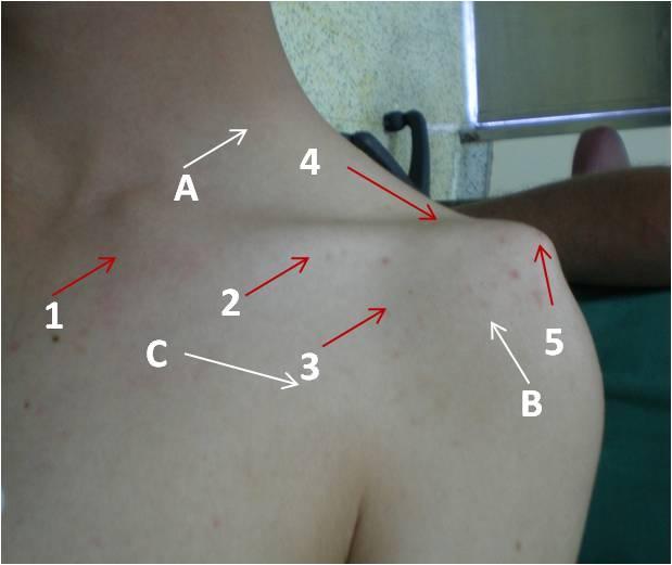 1 Omuz Anatomisi Dr. Ulunay Kanatlı Omuz eklemi vücudun hareket genişliği en fazla olan eklemidir.