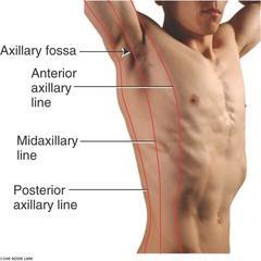 Linea axillaris anterior Linea