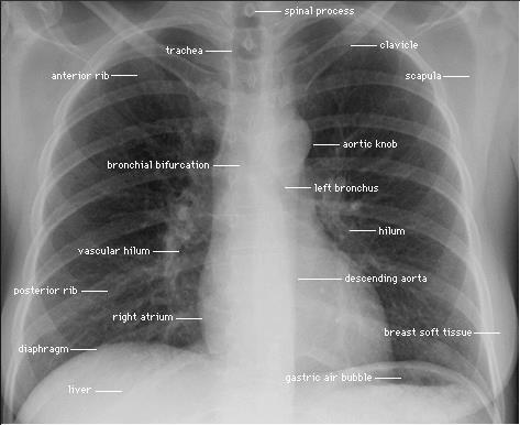 Thorax