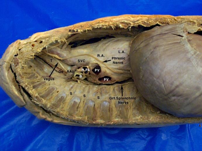 Merkezden geçmeyen bir sagittal kesitin sağdan görünüşü AAz V.