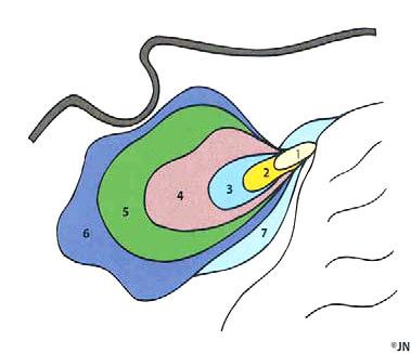 6) (Çelik 2006). Şekil 1.5. Sinus frontalis in doğum sonrası gelişimi (Çelik 2006). Cellulae ethmoidales 3-4. ayda gelişmeye başlarlar.