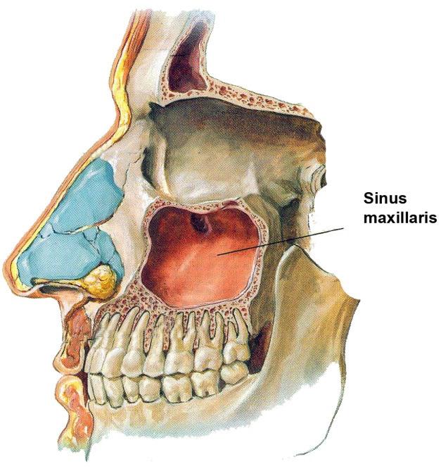 Şekil 1.26. Sinus maxillaris (Putz ve Pabst 2001). Sinus tavanı ile orbita arasında çoğunlukla kemik bir duvar bulunur.