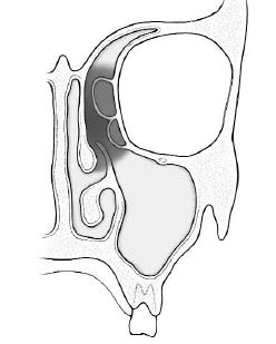 Şekil 1.29. OMK in medial den görünümü (Earwaker 1993). Şekil 1.30. OMK in anterior dan görünümü ( Edizer 2005).