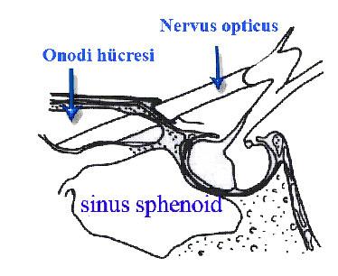 Şekil 1.36. NO, OH ve SS in ilişkisi (Earwaker 1993). Şekil 1.37. Aksiyal kesitte NO nun SS ve OH içinden geçişi. 1.OH, 2.SS (Earwaker 1993).