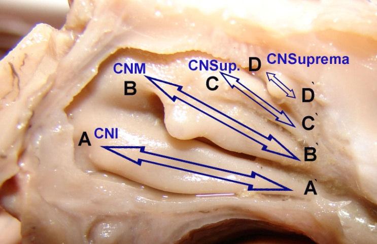 anterior u arası mesafe ölçümü (Şekil 2.6). Şekil 2.6. Ostium pharyngeum tubae auditivae (OPTA) ile os maxilla spina nasalis anterior (SNA) u arası mesafe.