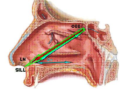 11. Limen nasi (LN) ve ostium sinus sphenoidalis (OSS) arası mesafe, Ostium sinus sphenoidalis in horizontal düzlem ile