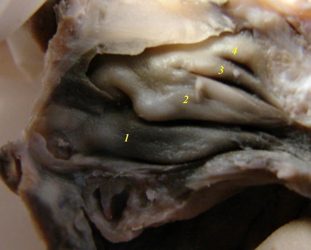 Şekil 3.3. 26 haftalık fetusta, concha nasalis suprema ile birlikte 4 adet konka.