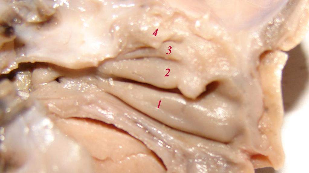 Şekil 3.5. 22 haftalık fetusta, concha nasalis suprema ile birlikte 4 adet konka.