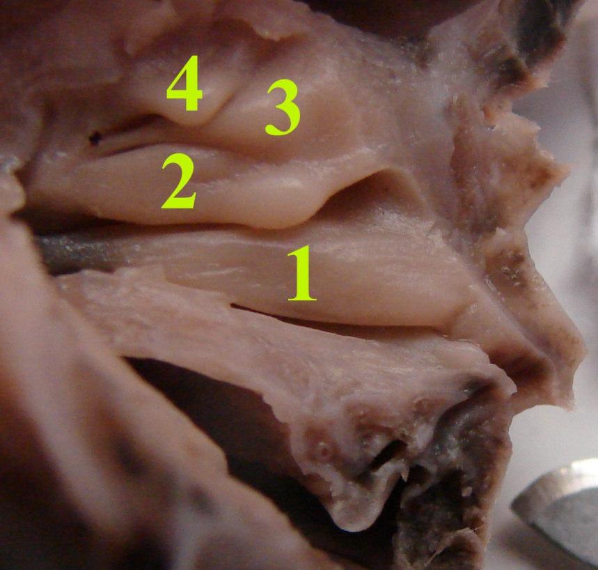 Şekil 3.7. 22 haftalık fetusta, concha nasalis suprema ile birlikte 4 adet konka.