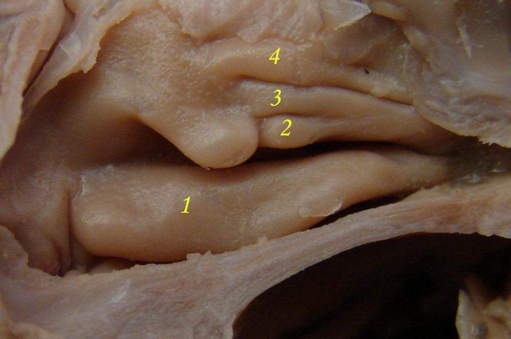 1; concha nasalis inferior, 2; concha nasalis media, 3 ; concha nasalis superior, 4; concha nasalis suprema. Şekil 3.