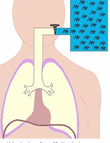 TLC, RV, FRC basit spirometreyle ölçülemez