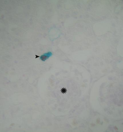 Böbrek intersitisyumunda AB/SO(+) (mikst) mast hücresi (ok başı), glomerulus (asteriks), Alcian blue/safranin O, X1100.