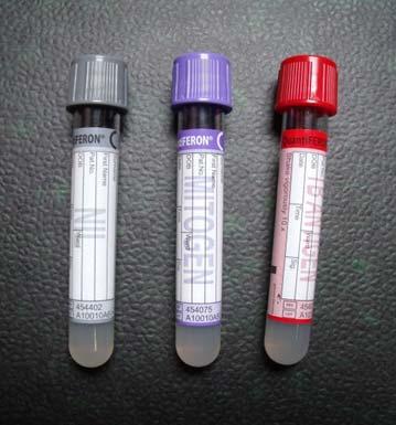 Gerekli görülürse latent TB enfeksiyonu taraması amacıyla IGST testleri