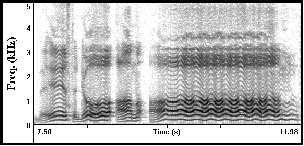 MDVP ĐLE ÖLÇÜLEN DĐĞER PARAMETRELER Tremorla ilgili olanlar: fo Tremor Frekansı (fo Tremor Frequency, Fftr), Amplitüd Tremor Frekansı (Amplitude Tremor Frequency, Fatr), fo Tremor Şiddet Đndeksi (F0