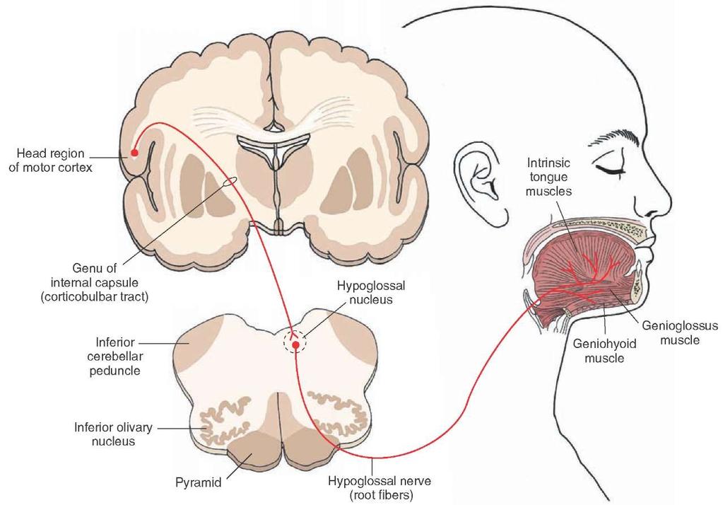 N. hypoglossus'un supranuclear lezyonu Hasta dilini dışarı çıkardığı zaman, dilin lezyonun karşı tarafına doğru kaydığı görülür.