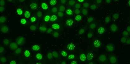 Sadece mitoza hazırlanan hücrelerde görülür.