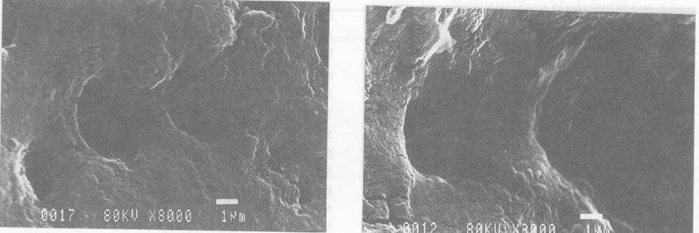 Resim 5. Süt molar dentin yüzeyindeki smear tabakasının, 15 saniye %35 fosforik asit uygulaması ile uzaklaştırılmış görüntüsü.