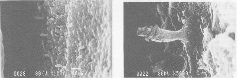 Sürekli molar dentin yüzeyine, Clearfil Liner Bond 2, adeziv sistem uygulanmış, test örneğinin demineralizasyon işleminden sonraki rezin uzantı morfolojisi, x 5000 büyütme. Resim 9.