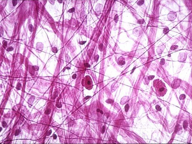 Hücreler Arası Madde: Hücre ve liflerin arasını doldurur. Dokular içinde en çok ara madde bağ dokusunda bulunur.