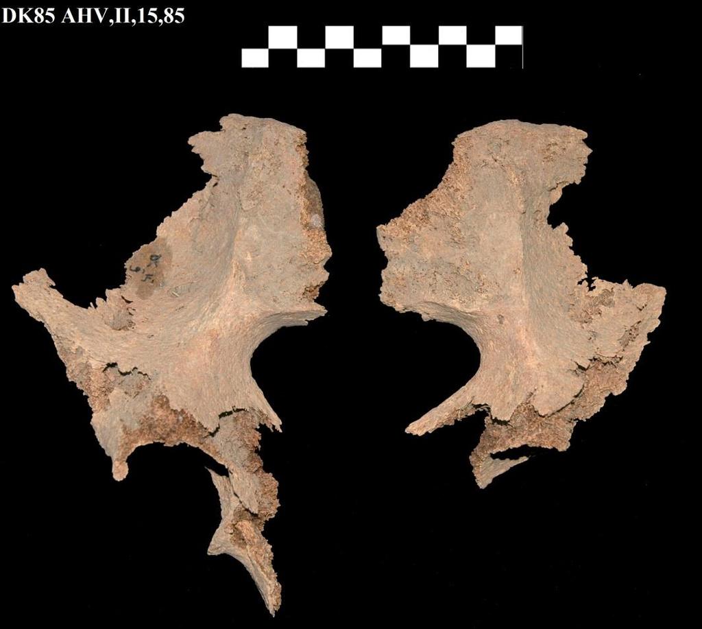 Resim 4: DK85 AHV,II,15,85 envanter numaralı kadın bireye ait coxa kemikler.