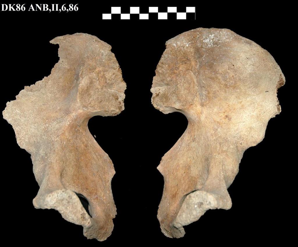 Resim 5: DK86 ANB,II,6,86 envanter numaralı erkek bireye ait sol ve sağ coxa kemikleri. Safha 7.