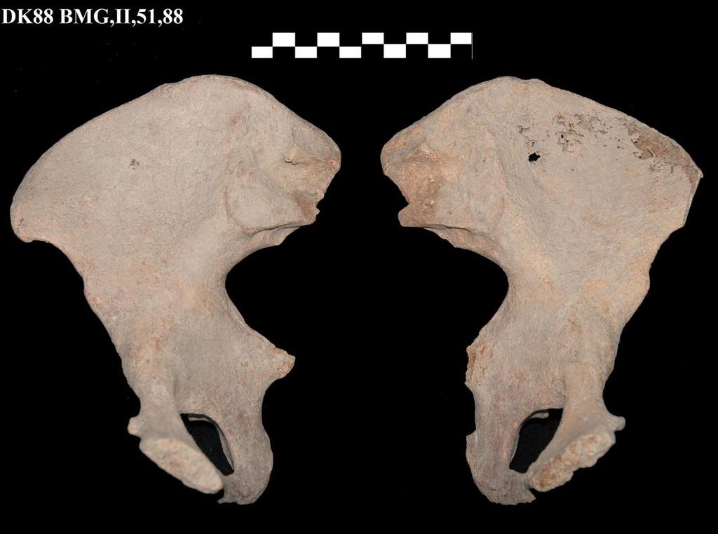 Resim 8: DK88 BMG,II,51,88 envanter numaralı kadın birey ait sol ve sağ coxa kemikleri. Safha 4. 35-39 yaş.