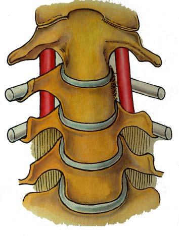 11 Şekil 1.6. Boyun omurlarının, m. longus colli nin tuberculum anterius un lateraline kadar diseke edilmesinden sonra, ön taraftan görünüşü.
