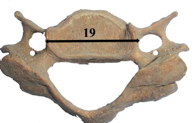 39 Şekil 2.12. Boyun omurlarının önden görünüşü. Proc. costalis in genişliği (14), yüksekliği (15).