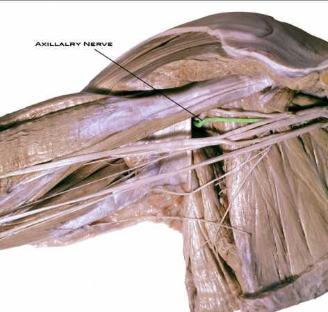 N. axillaris hasarı En sık humerus boynu kırıklarında ve omuz ekleminin çıkıklarında yaralanır.
