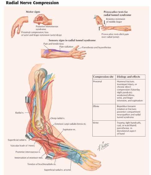N. Radialis yaralanması (axilla da yaralanma) Ön kol ve el