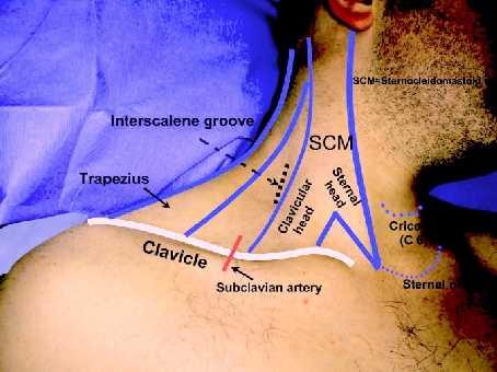 arka kenarı ile clavicula