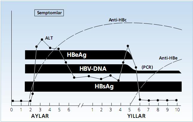 Şekil 7: Kronik HBV 
