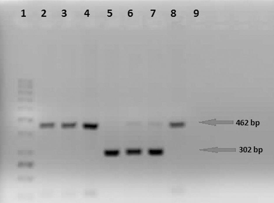 Sar AN, Biçmen M, Gülay Z. Şekil 1. pampc geni taşıyan izolatlara ait agaroz jel elektroforezi görüntüsü (Hat 1: 50 bç DNA belirteci; Hat 2-4: LAT-1-LAT-4/CMY-2-CMY-7/BIL-1 gen bölgesi pozitif E.