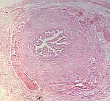 çok az sayıda kat bulunur c) Kirpikli epitel hücre