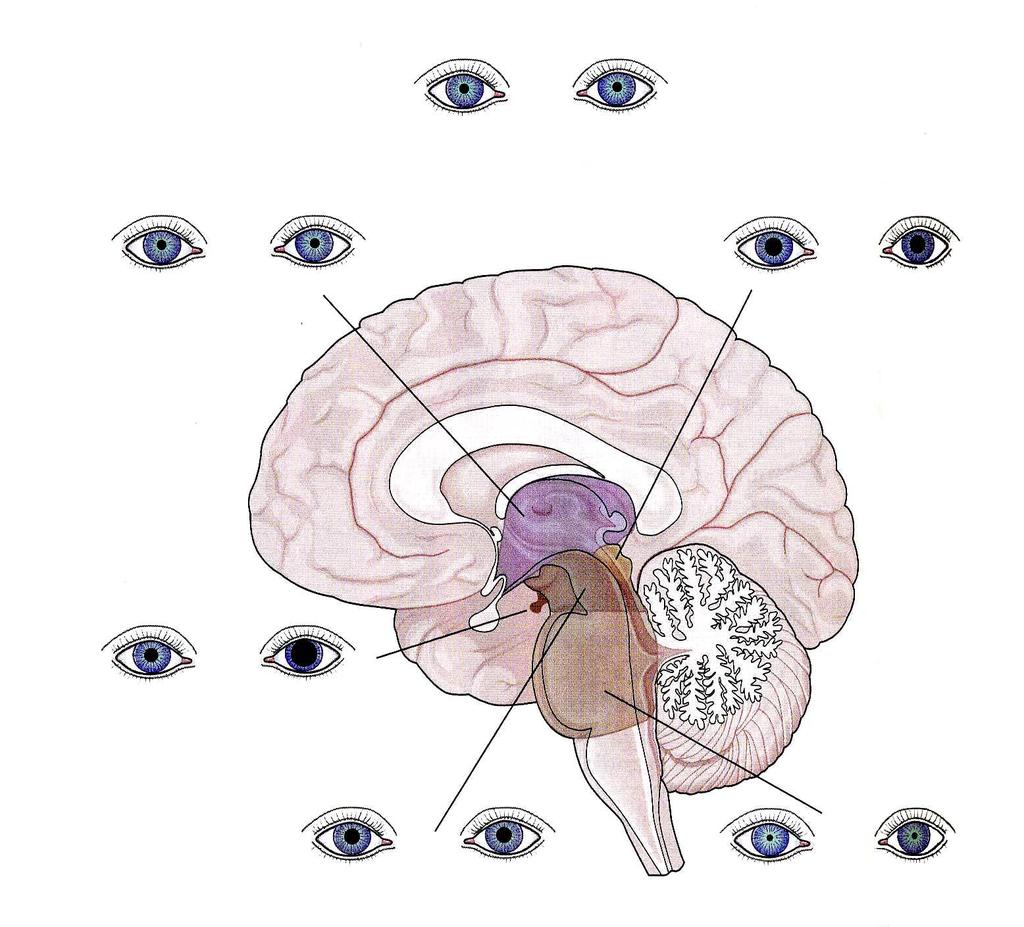 Pupiller metabolik ansefalopati: küçük, reaktif diensefalik: küçük, reaktif pretektal: