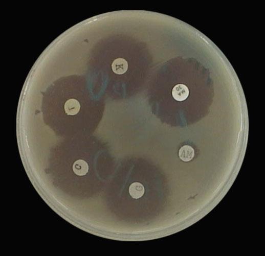 Antibiyogram için Mueller-Hilton agar besiyeri kullanılır. Besiyeri yüzeyine 10 9 hücre/ml yoğunluktaki bakteri süspansiyonu hazırlanıp dökülür, gerekirse steril eküvyonla yayılması sağlanır.