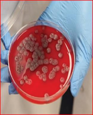 Kültürler 3 5 gün boyunca inkübe edilmesine rağmen kültür sonucu hâlâ negatif ise PD sıvısı tekrar hücre sayımı, formül lökosit, mantar ve mikrobakteriyel kültür testlerine gönderilmelidir.