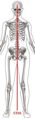 96 2. Coronal Balance Normally, the position of the spine is perpendicular to the coronal plane.