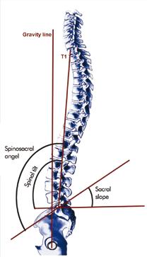 Figure 10: If C7 is at an appropriate position, cervical lordosis is followed by thoracic lordosis and lumbar lordosis, which are