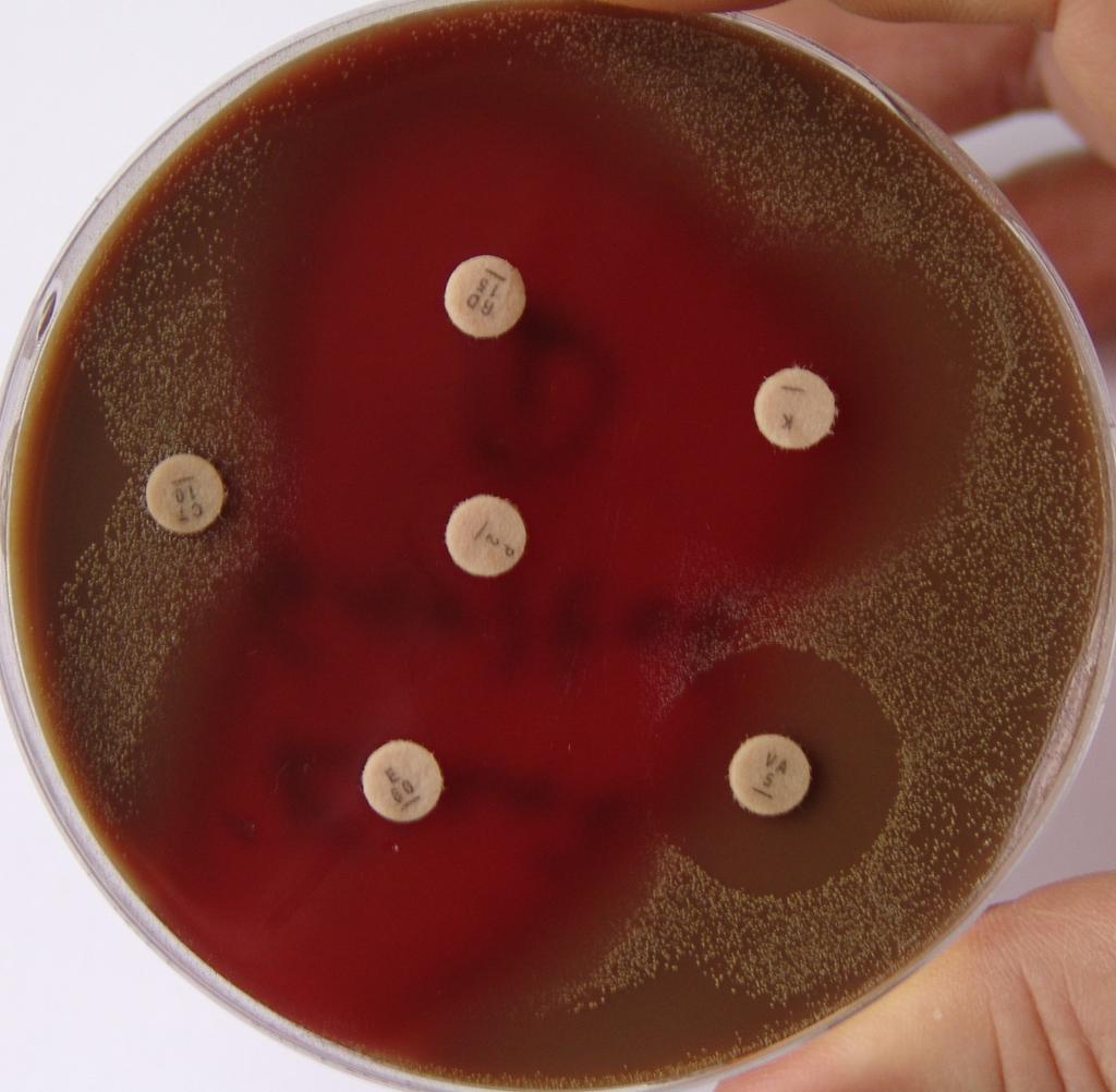 4 İzole Edilen Anaerop Bakterilerin Biyokimyasal Özelliklerinin İncelenmesi ve Tanımlanması İçin Yapılan İşlemler İzole edilen anaerop bakterilerin tanımlanması için öncelikle antibiyotik tanı disk