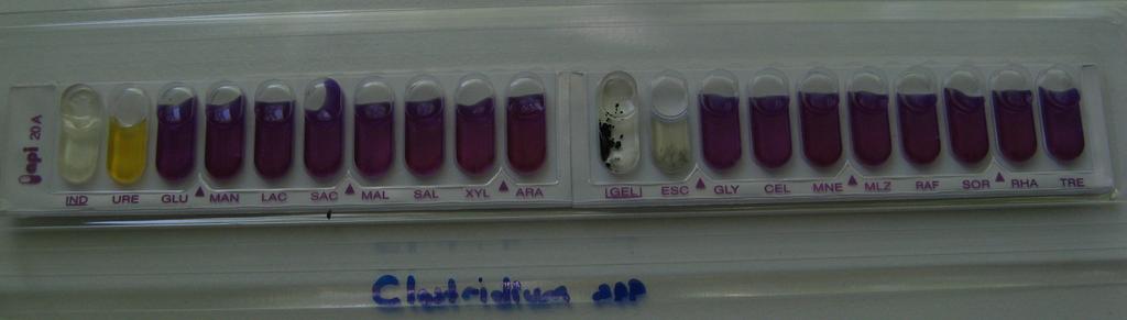 fragilis, altta; Clostridium spp.) (Çalışmamızdan). Klasik tanı testleri ile API 20 A testinden elde edilen sonuçlar birlikte değerlendirilerek bakterilerin identififasyonu yapıldı. 3.