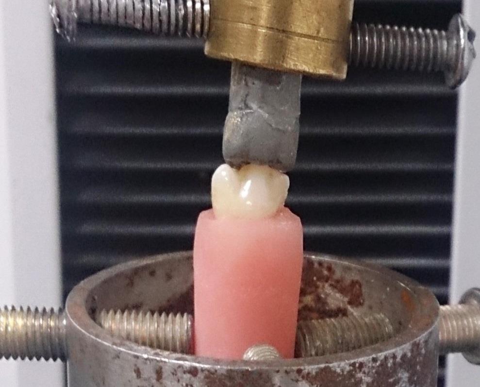 Şekil 3.50. Baskı testi için Instron test cihazına yerleştirilen süt II. azı dişi ve diş formu Kuvvet uygulayacak olan diş formlarının ve test edilecek olan süt II.