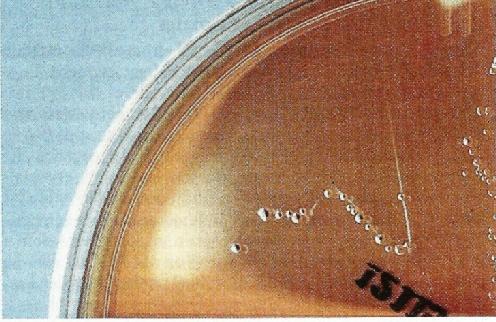 fragilis grubu Safraya dirençli diğer bakteriler Bilophila